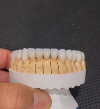 Indent Dental Laboratory Kandivali East